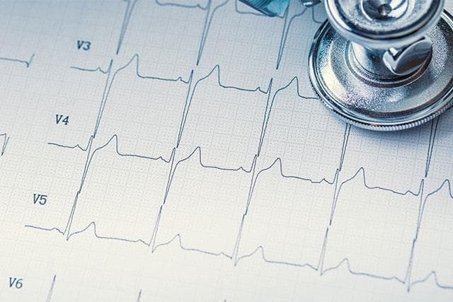 Lectura e interpretación de ECG